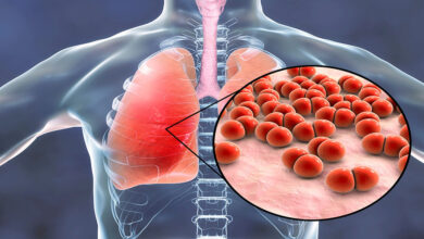 Photo of احمِ رئتيك من الالتهاب الرئوي.. نصائح ذهبية لحياة صحية